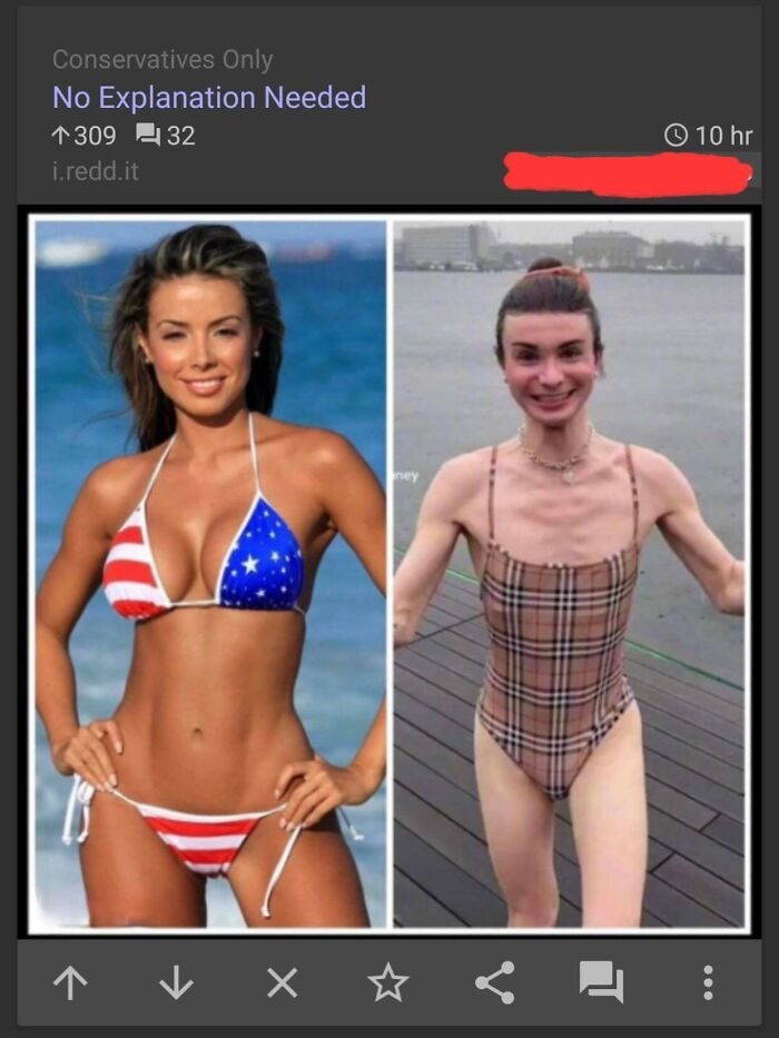 They Don’t Know There’s Cisgender Women Who Have Very Flat Breasts Or None At All