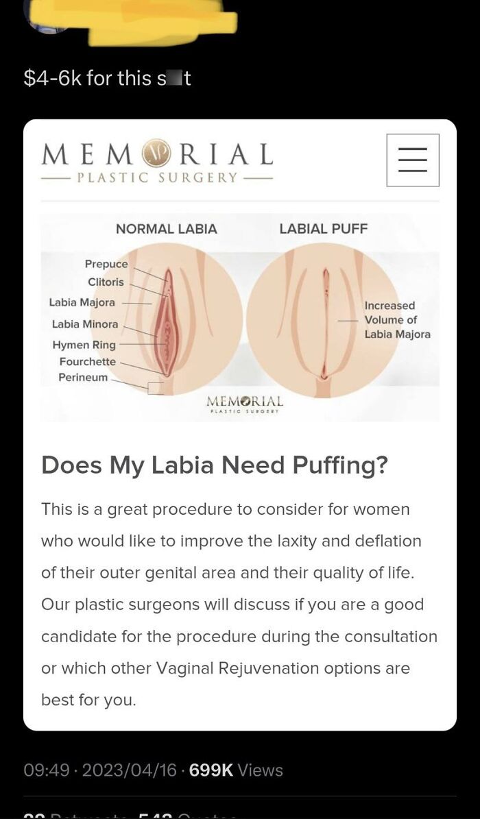 Wake Up Babe, A New Surgical Procedure To Make Us Feel Insecure About Our Genitalia Just Dropped!