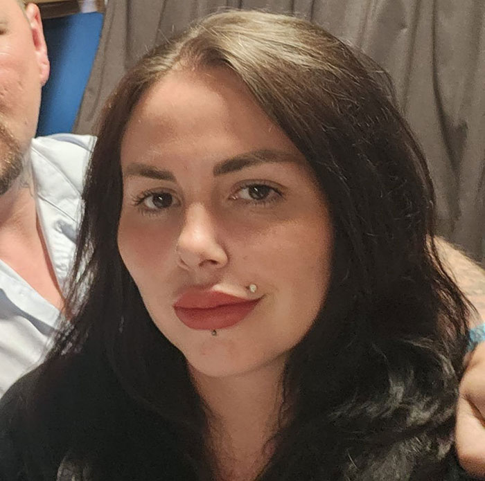 33-Year-Old Mom Of Five Is UK&rsquo;s First Person To Lose Life In UK From Undergoing BBL