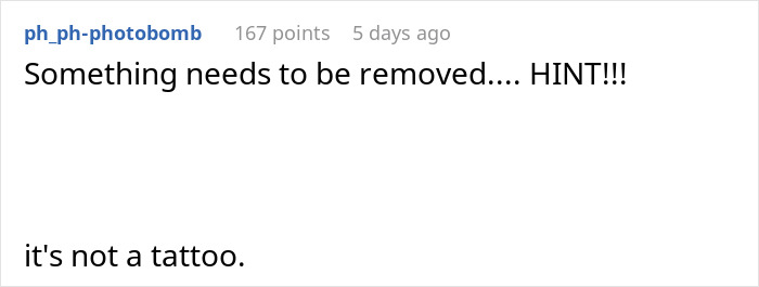Reddit comment about something that needs removal, hinting it's not a tattoo.