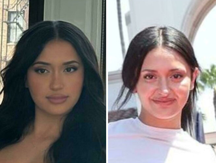 Face Tuned (?) And Looks Completely Different