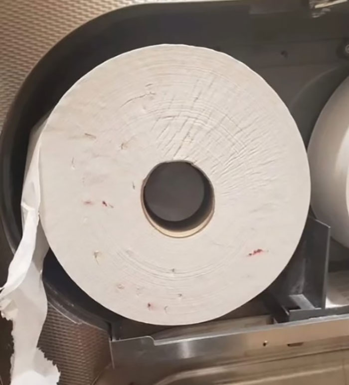 Viral Pic Of Bloody Toilet Paper Soiled By Drug Users Sparks HIV Misinformation, Doctor Reacts