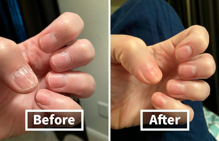 Nail Envy? Not Anymore! This Nail Strengthening Cream Is The Secret To Long, Strong Nails That Will Have Everyone Asking, 'What's Your Secret?