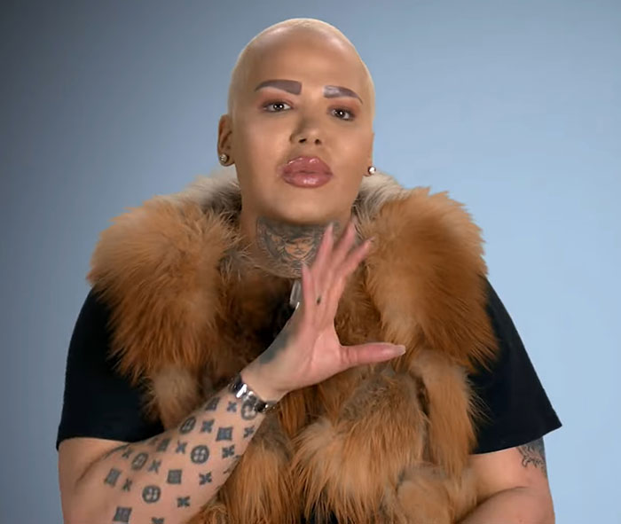 33-Year-Old Mom Of Five Is UK&rsquo;s First Person To Lose Life In UK From Undergoing BBL