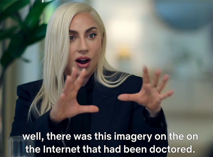 Lady Gaga Reveals Anatomy Controversy Shouldn’t Be Addressed To Protect People’s “Wellbeing” Lady Gaga Reveals Anatomy Controversy Shouldn’t Be Addressed To Protect People’s “Wellbeing”