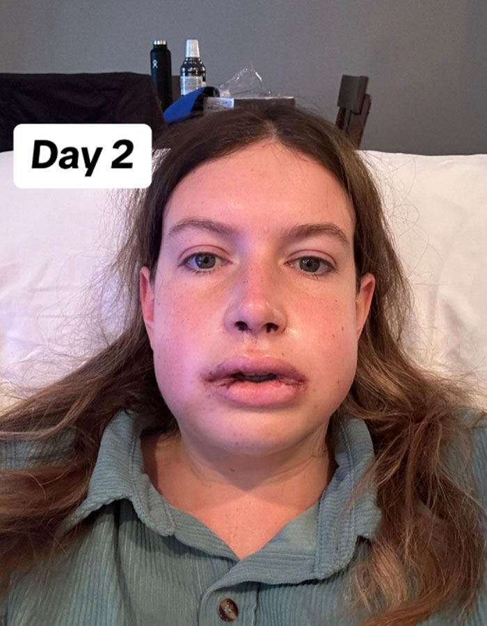 Woman Stuns Viewers With Surgery Results After Having Her &ldquo;Jaw Of An 80-Year-Old&rdquo; Fixed