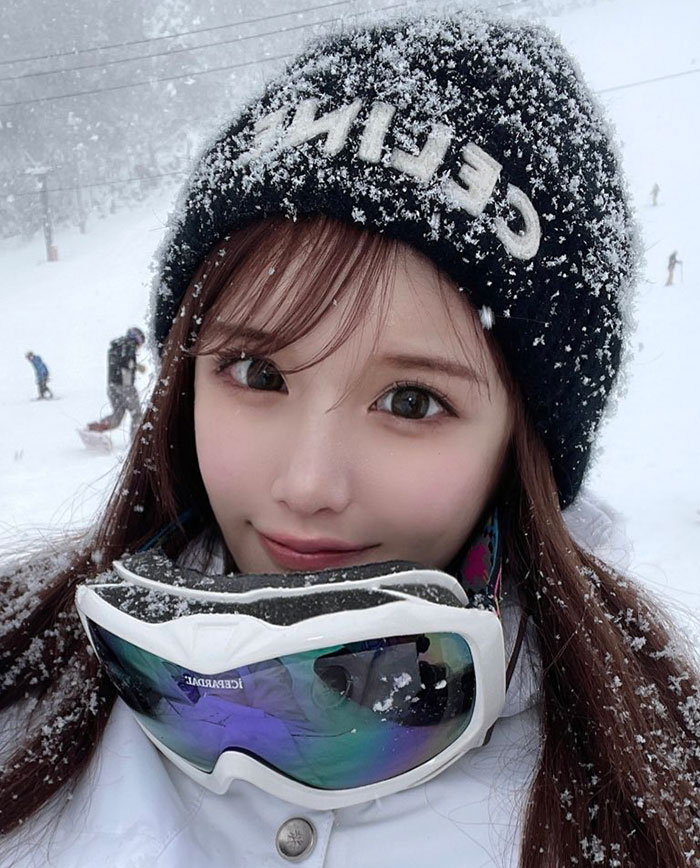 "Finally Beautiful": Japanese Model Becomes Unrecognizable After 20+ Plastic Surgeries