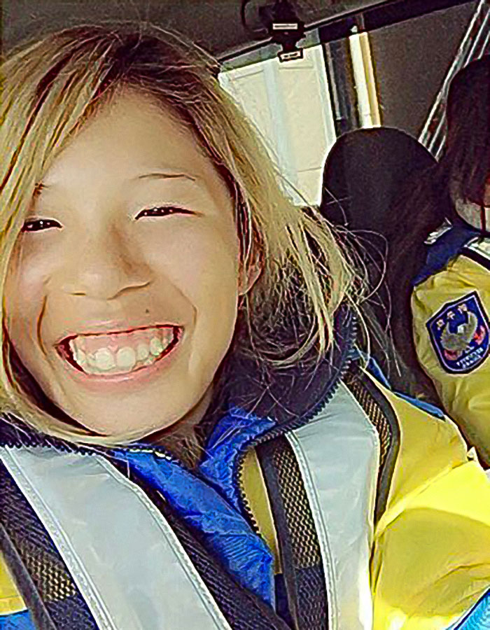 "Finally Beautiful": Japanese Model Becomes Unrecognizable After 20+ Plastic Surgeries