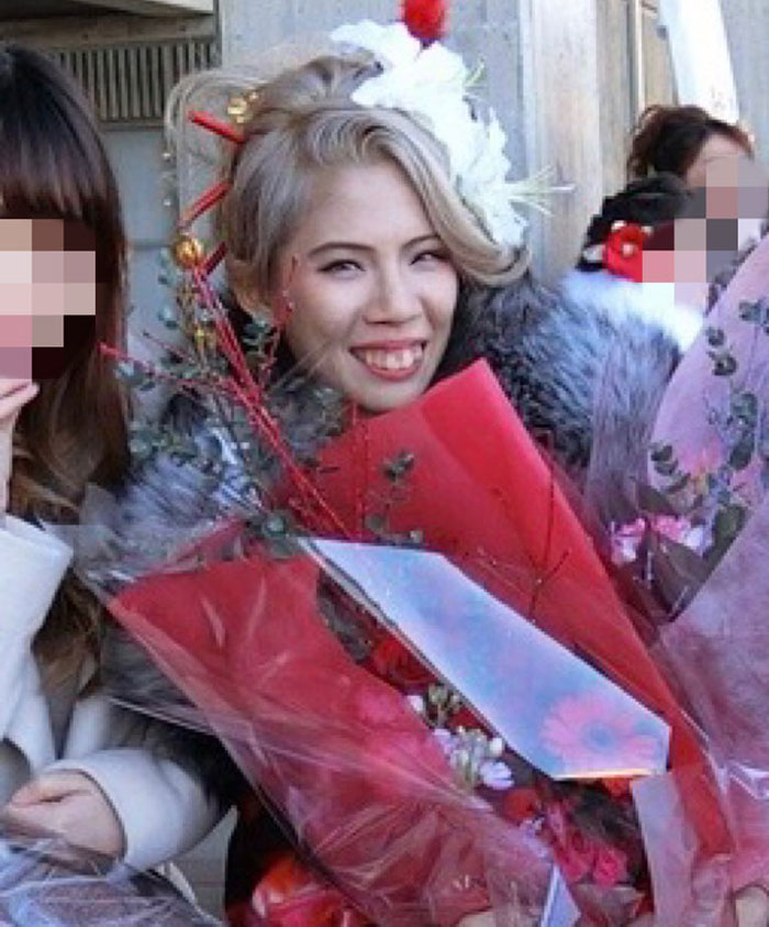 "Finally Beautiful": Japanese Model Becomes Unrecognizable After 20+ Plastic Surgeries