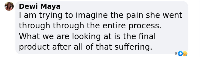 "Finally Beautiful": Japanese Model Becomes Unrecognizable After 20+ Plastic Surgeries