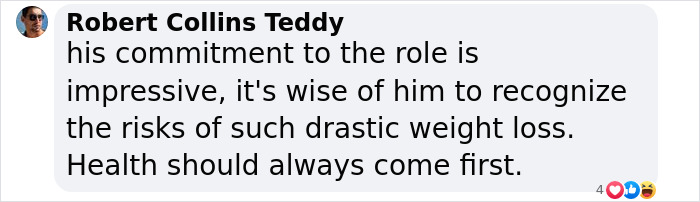 &ldquo;Probably Shouldn&rsquo;t Do This Again&rdquo;: Joaquin Phoenix Followed &ldquo;Horrible Diet&rdquo; For &ldquo;Joker&rdquo;