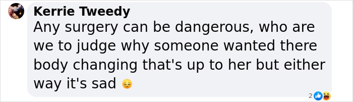 33-Year-Old Mom Of Five Is UK&rsquo;s First Person To Lose Life In UK From Undergoing BBL