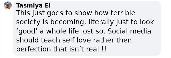 33-Year-Old Mom Of Five Is UK&rsquo;s First Person To Lose Life In UK From Undergoing BBL