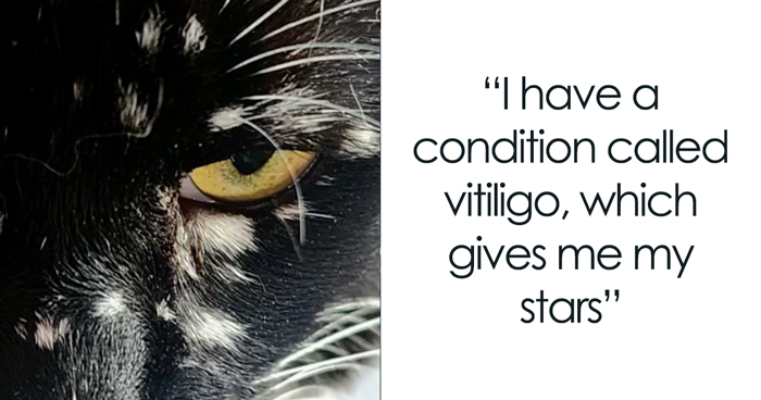 Magical Cat Has Condition That Makes His Fur Look Like A Galaxy Of Stars, People Are Obsessed