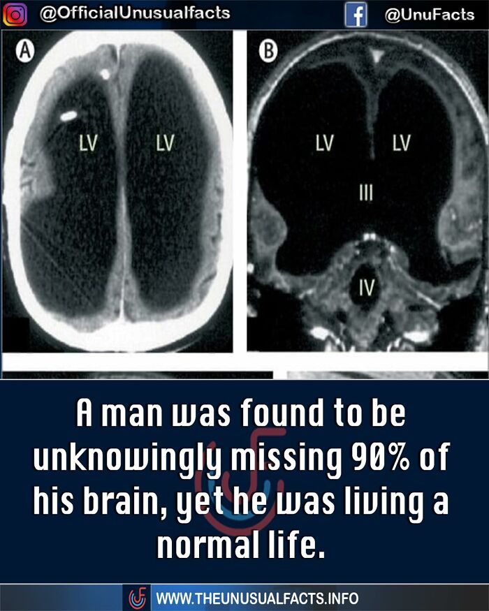 Unusual-Interesting-Facts