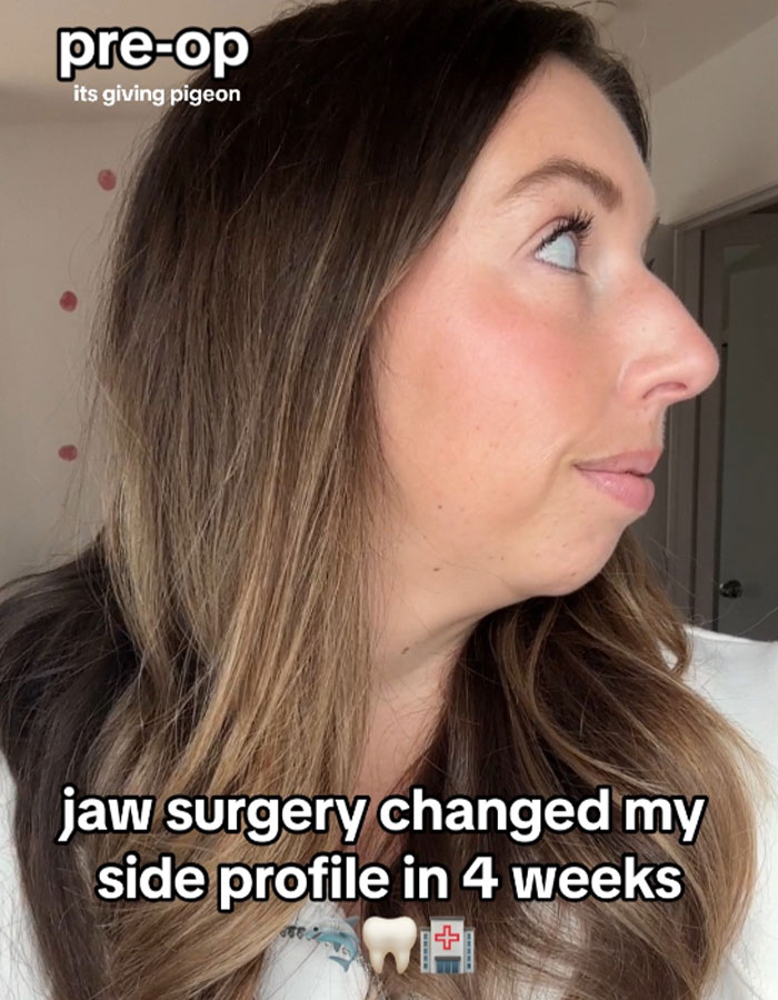 Woman Stuns Viewers With Surgery Results After Having Her &ldquo;Jaw Of An 80-Year-Old&rdquo; Fixed