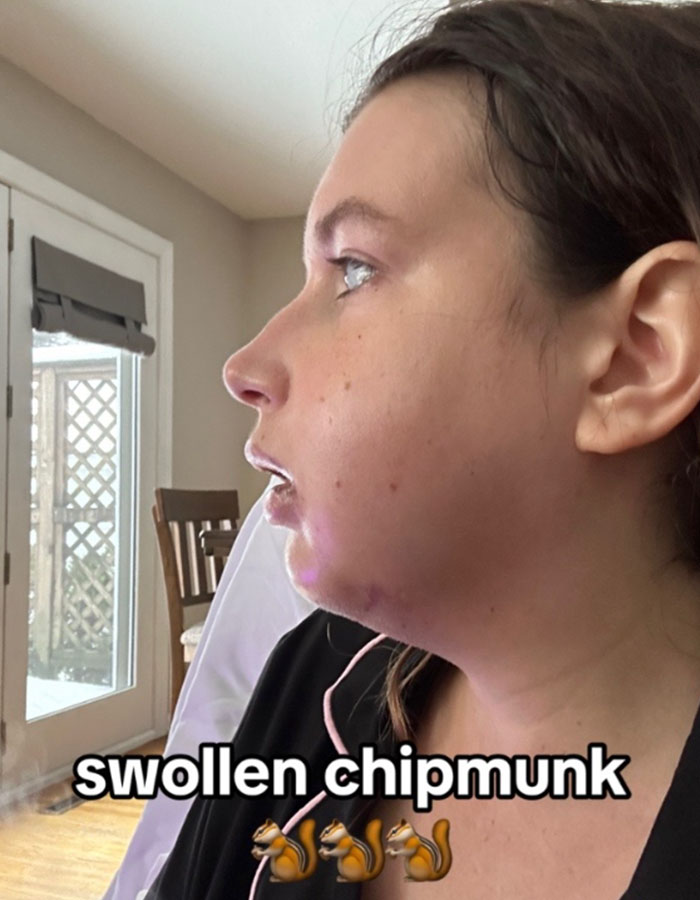 Woman Stuns Viewers With Surgery Results After Having Her &ldquo;Jaw Of An 80-Year-Old&rdquo; Fixed