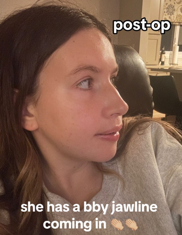 Woman Stuns Viewers With Surgery Results After Having Her &ldquo;Jaw Of An 80-Year-Old&rdquo; Fixed