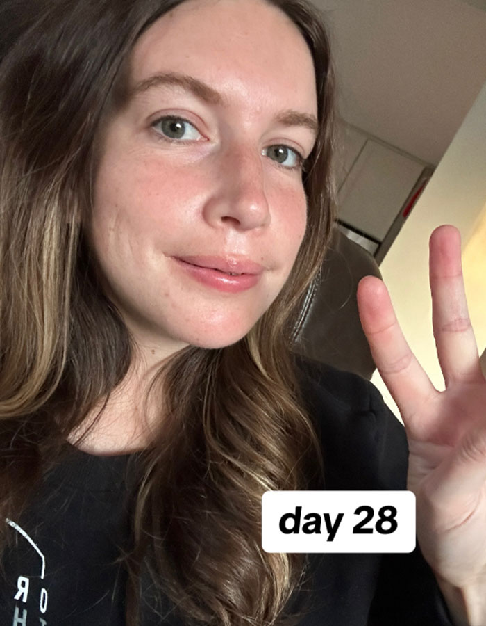 Woman Stuns Viewers With Surgery Results After Having Her &ldquo;Jaw Of An 80-Year-Old&rdquo; Fixed