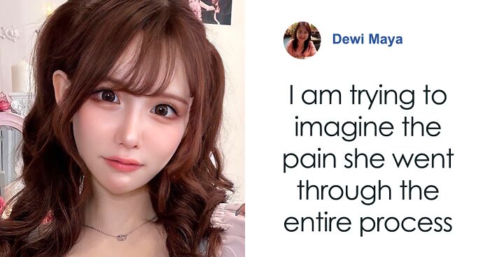 “Finally Beautiful”: Japanese Model Becomes Unrecognizable After 20+ Plastic Surgeries