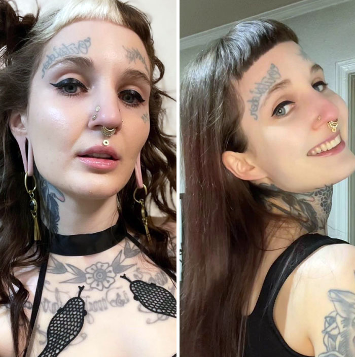 My Ears Before, And After Getting Them Reconstructed (Almost 3 Years Healed)