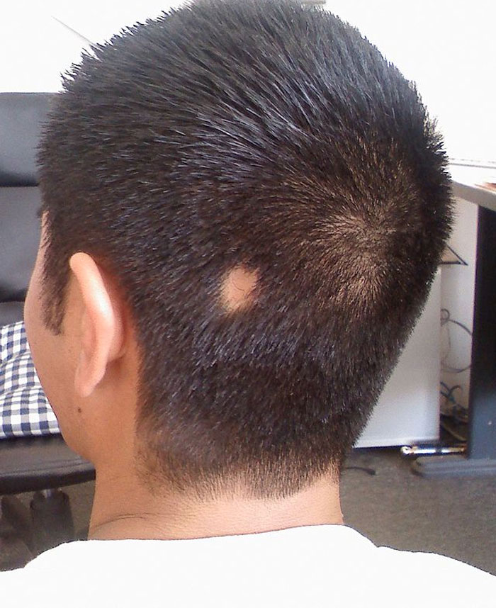 Man with a small bald patch on the back of his head, illustrating stories about Kevin and village deprivation themes.