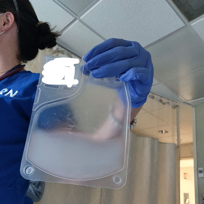 Here Are My Removed & Genetically Modified White Blood Cells, About To Be Put Back In To Hopefully Cure My Cancer! This Is T-Cell Immunotherapy!