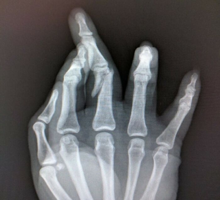 30 Times People Injured Themselves In Dumb Ways And Just Had To Warn Others