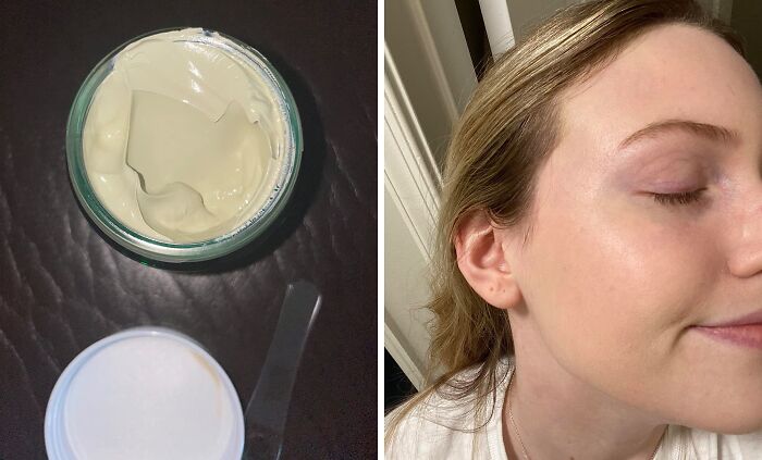 Neutralize Redness And Sallowness With Tiger Grass Color Correcting Treatment, A Powerful Solution For A More Even-Toned Complexion