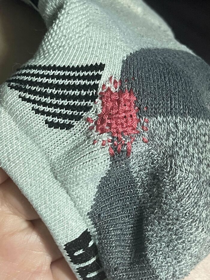 Close-up of a sock with a visible mended hole using red thread, showcasing creative and cool visible repairs.