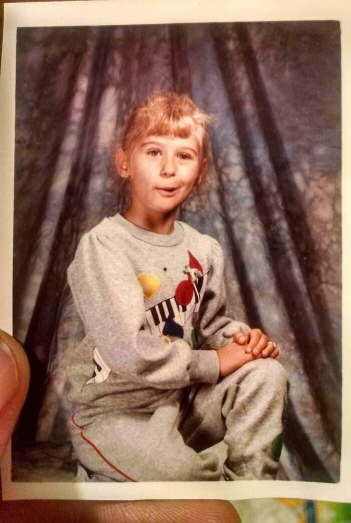 I Was Trying To Smile Like A Ninja Turtle. Doesn't Translate Well When Actual Humans Attempt It