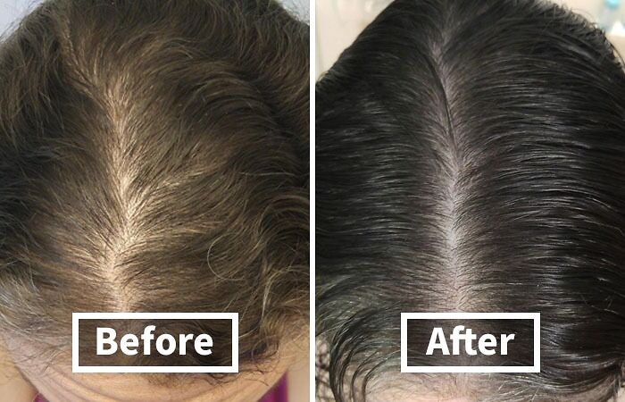 Thinning Locks Meet Their Match With This Powerhouse Rosemary And Biotin Shampoo For Thinning Hair