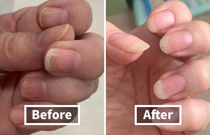 Nourish Your Nails Back To Health With The Nail Strengthener And Nail Growth Cream, A 2-In-1 Treatment That Fortifies And Grows Your Nails, Leaving Them Stronger, Longer, And More Resilient
