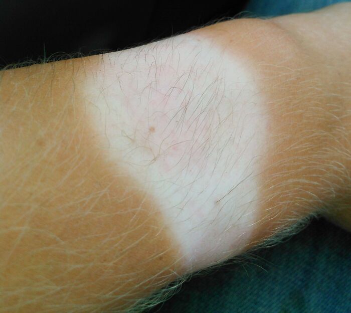 The Hair On The Pale Part Of My Watch Tan Is Black, But The Hair On The Tan Part Of My Arm Is White