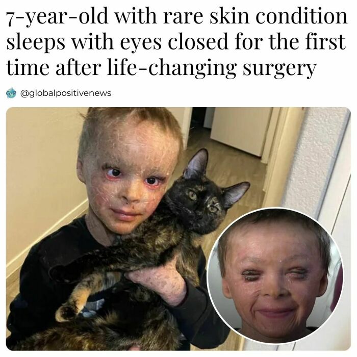 Child holding a cat, smiling after successful surgery. Global positive news highlighting restored faith in humanity.