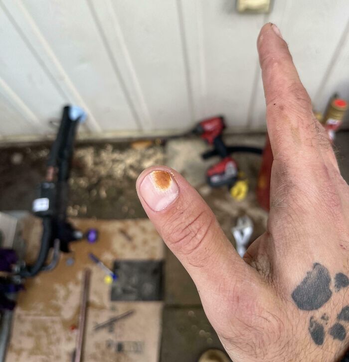Less Than One Second Of 3,000°f Flame To A Finger Nail