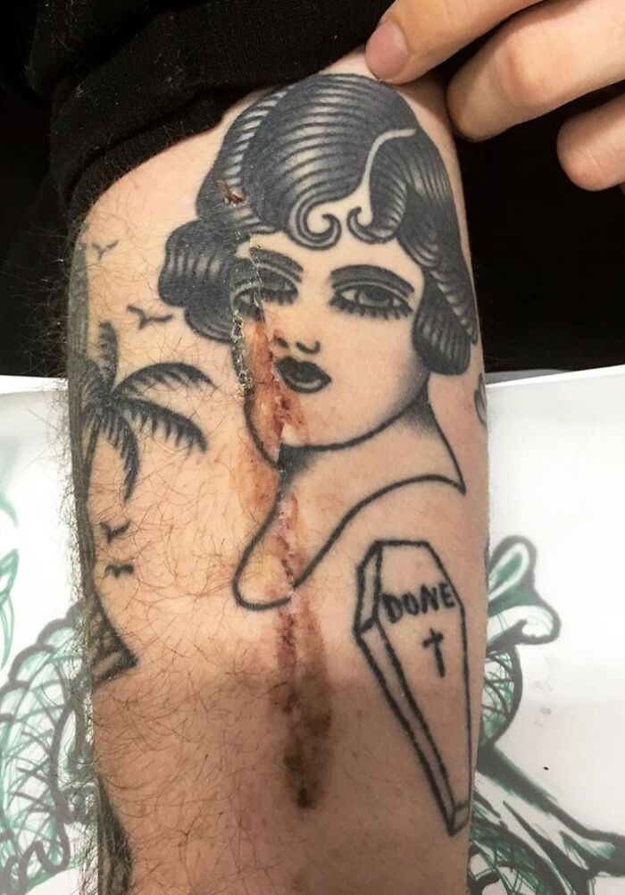 My Friend Broke His Arm And The Surgery Misaligned His Tattoo