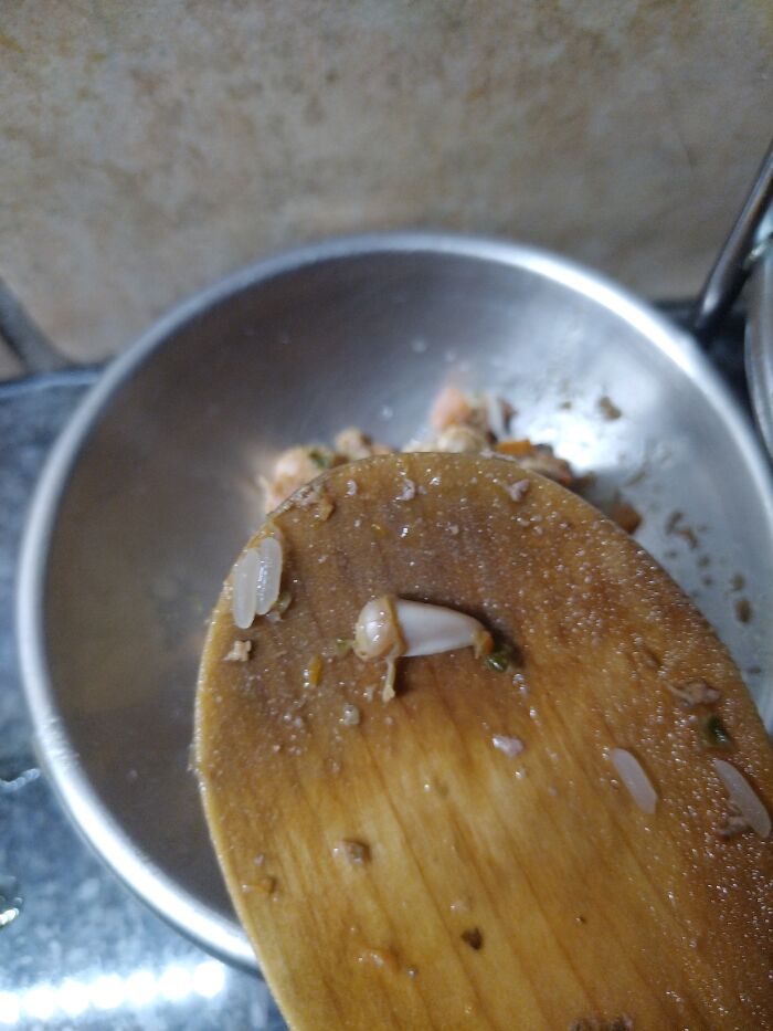 Chicken Claws. Found In Pet Mince. That I Bought For My Doggo With Bowel Issues