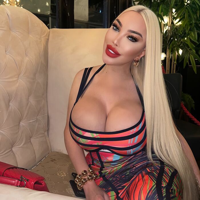 Jessica Alves Covered In Bandages After Fifth Facelift: &ldquo;3 Or 4 Inches [Of Skin] Would Come Off&rdquo;