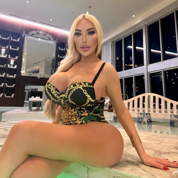 Jessica Alves Covered In Bandages After Fifth Facelift: &ldquo;3 Or 4 Inches [Of Skin] Would Come Off&rdquo;