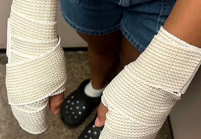 Outrage Erupts As Texas Cheerleaders Suffer Burns From Coach’s “Barbaric” Punishment Outrage Erupts As Texas Cheerleaders Suffer Burns From Coach’s “Barbaric” Punishment