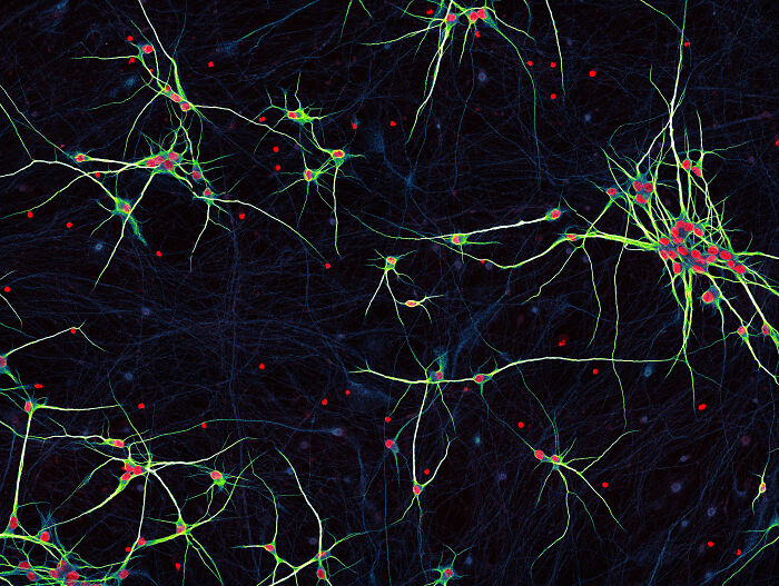 Microscopic image showing detailed neurons with bright green and red highlights from the 2024 Nikon Small World photomicrography contest.