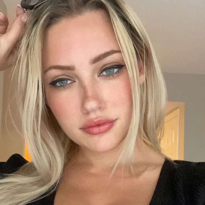 “Psycho” Plastic Surgeon Allegedly Used Ex As Slave, Forcibly Injected Fillers Without Anesthesia “Psycho” Plastic Surgeon Allegedly Used Ex As Slave, Forcibly Injected Fillers Without Anesthesia