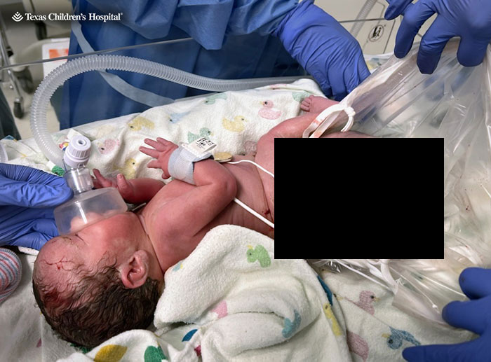 "Miracle Angel": Newborn Survives Life-Threatening 4-Lb. Tumor, Mom Candidly Shares Her Story "Miracle Angel": Newborn Survives Life-Threatening 4-Lb. Tumor, Mom Candidly Shares Her Story