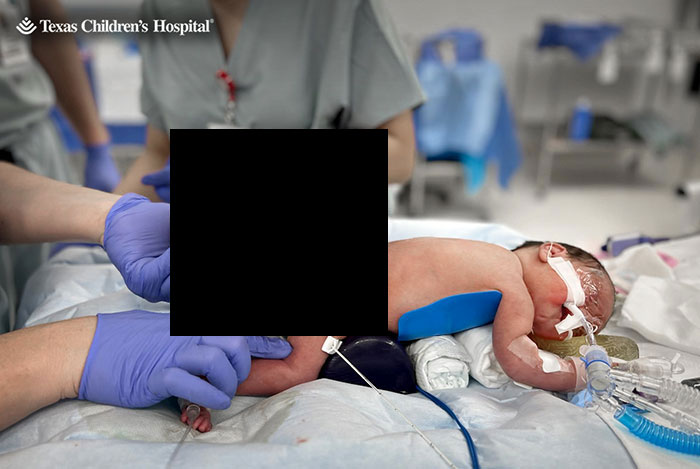 "Miracle Angel": Newborn Survives Life-Threatening 4-Lb. Tumor, Mom Candidly Shares Her Story "Miracle Angel": Newborn Survives Life-Threatening 4-Lb. Tumor, Mom Candidly Shares Her Story