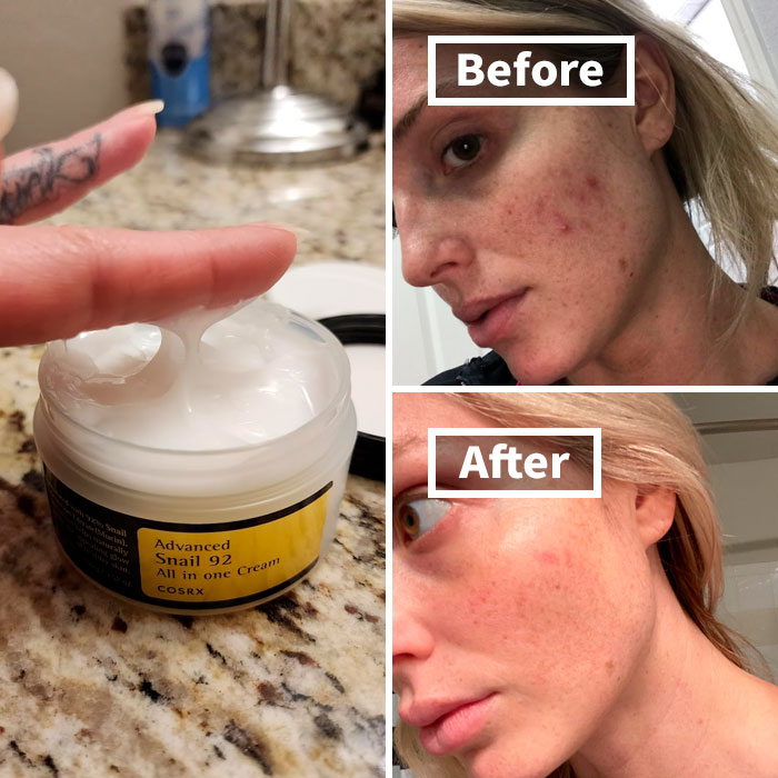 Skincare product for winter beauty issues showing before and after results.