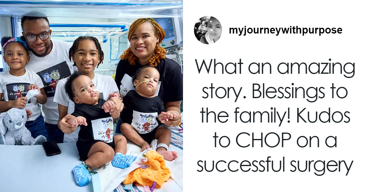 So Grateful”: Mom Of Successfully Separated Conjoined Twins