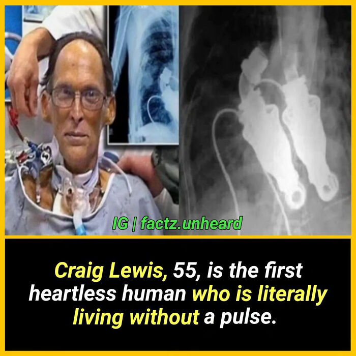 Interesting-Facts-Factzunheard