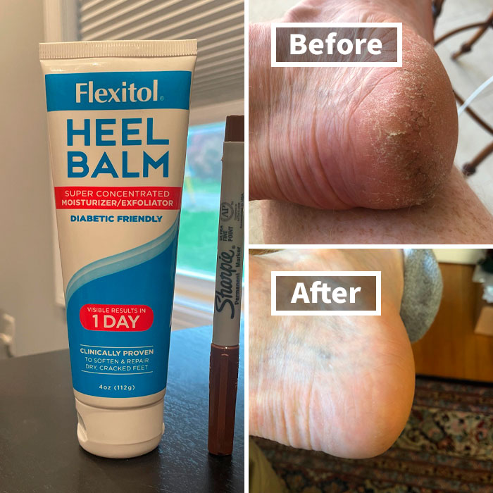 Flexitol Heel Balm for winter beauty woes, showing before and after images of improved heel condition.