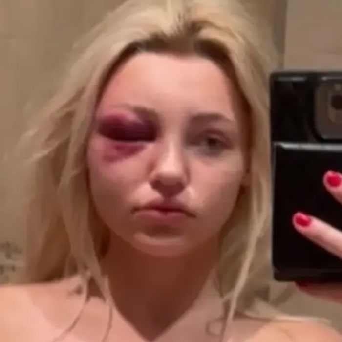 “Psycho” Plastic Surgeon Allegedly Used Ex As Slave, Forcibly Injected Fillers Without Anesthesia “Psycho” Plastic Surgeon Allegedly Used Ex As Slave, Forcibly Injected Fillers Without Anesthesia